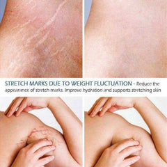 Crocodile Stretch Marks Remover Body Repair Cream