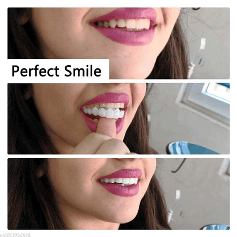 Image of Instant Perfect Smile Upper and Lower Flase Teeth Dental Veneers