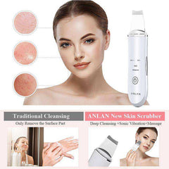 Ultrasonic Skin Scrubber Face Cleanser Peeling Shovel Vibration Massager