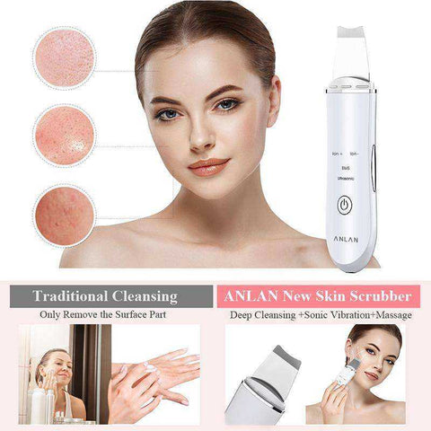 Image of Ultrasonic Skin Scrubber Face Cleanser Peeling Shovel Vibration Massager