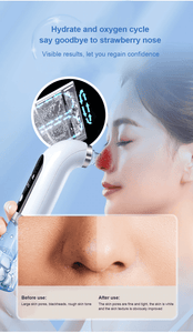 Electric Small Bubble Blackhead Remover Pore Vacuum Suction Cleaner