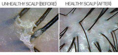 Anti Dandruff Sea Salt Exfoliating Shampoo