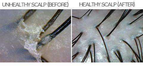 Anti Dandruff Sea Salt Exfoliating Shampoo