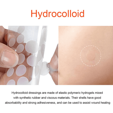 Image of Hydrocolloid Acne Patch Pimple Stickers