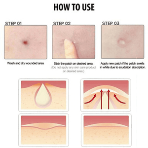 Hydrocolloid Acne Patch Pimple Stickers